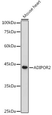 Western Blot: AdipoR2 AntibodyAzide and BSA Free [NBP2-92087]